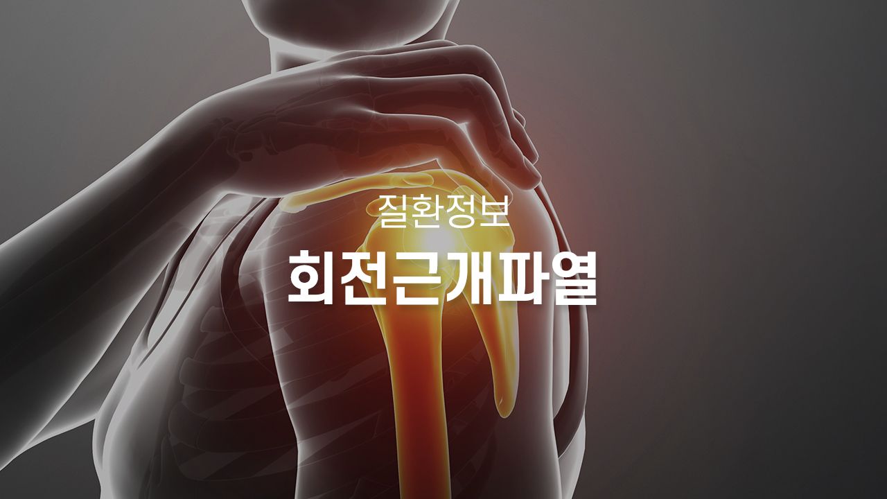 회전근개파열