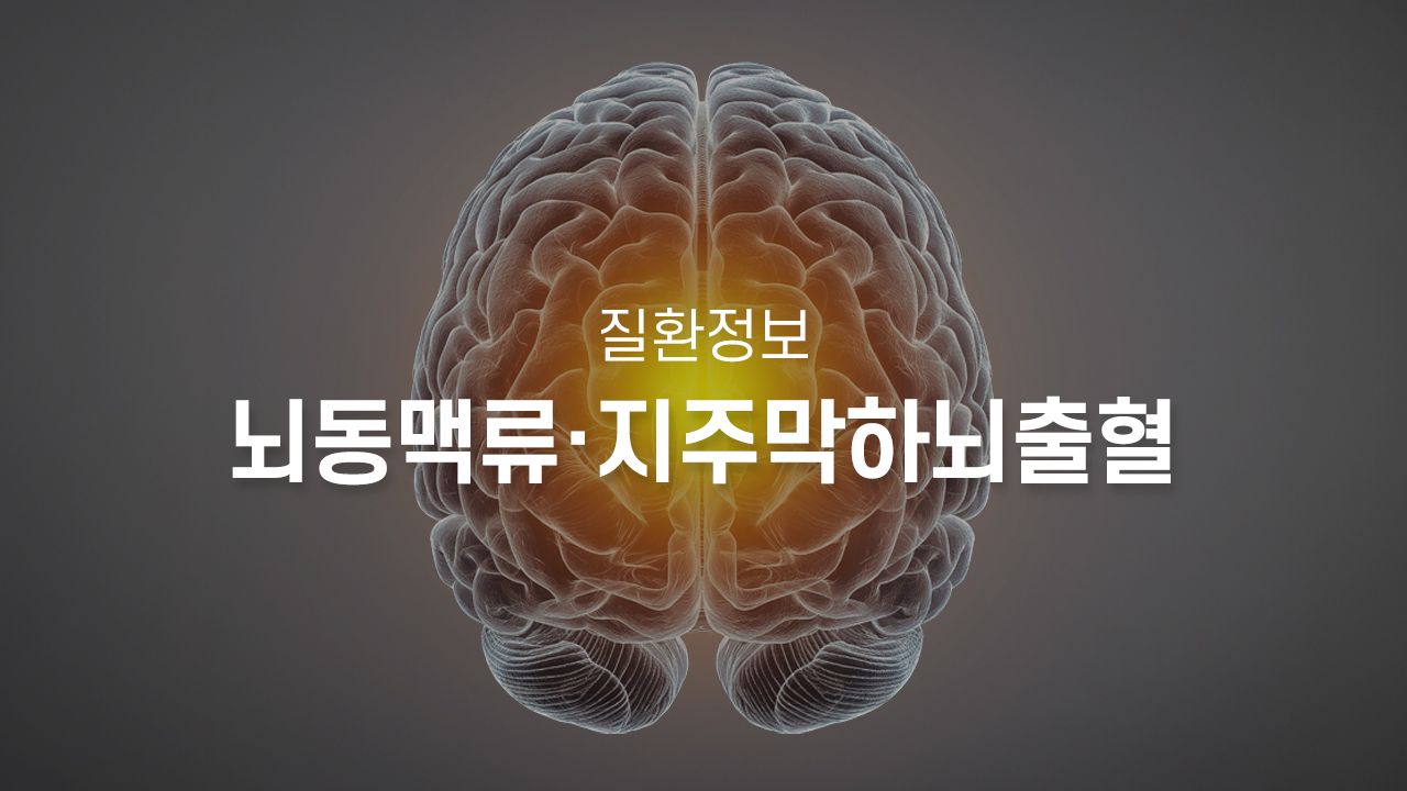 뇌동맥류·지주막하뇌출혈