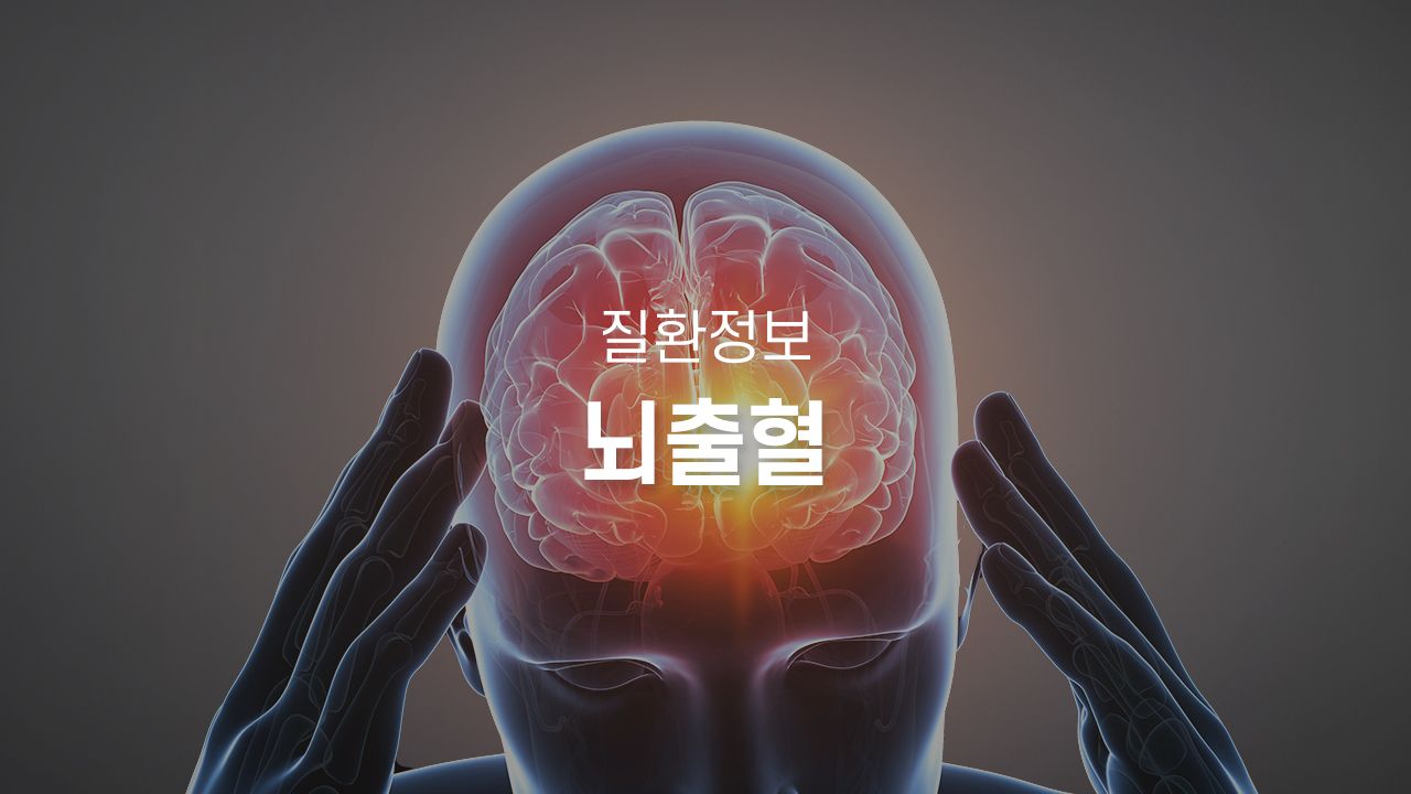 뇌출혈