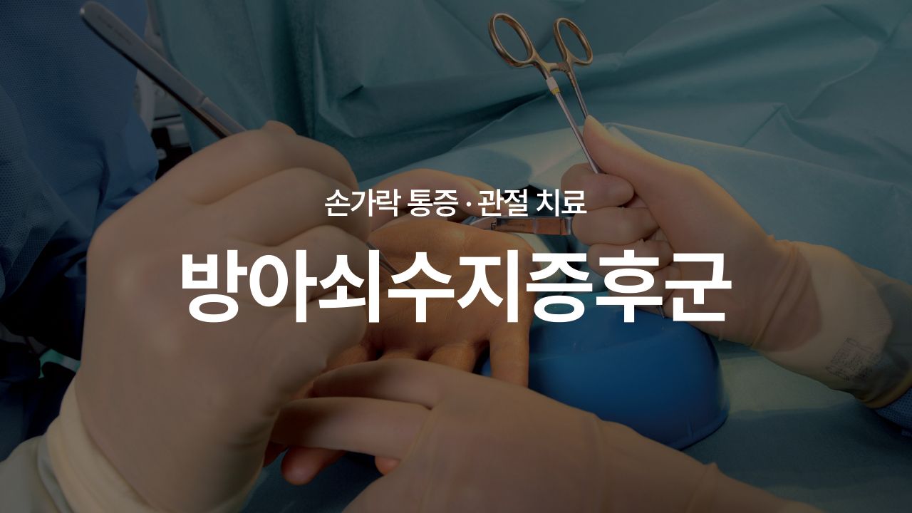 방아쇠수지증후군