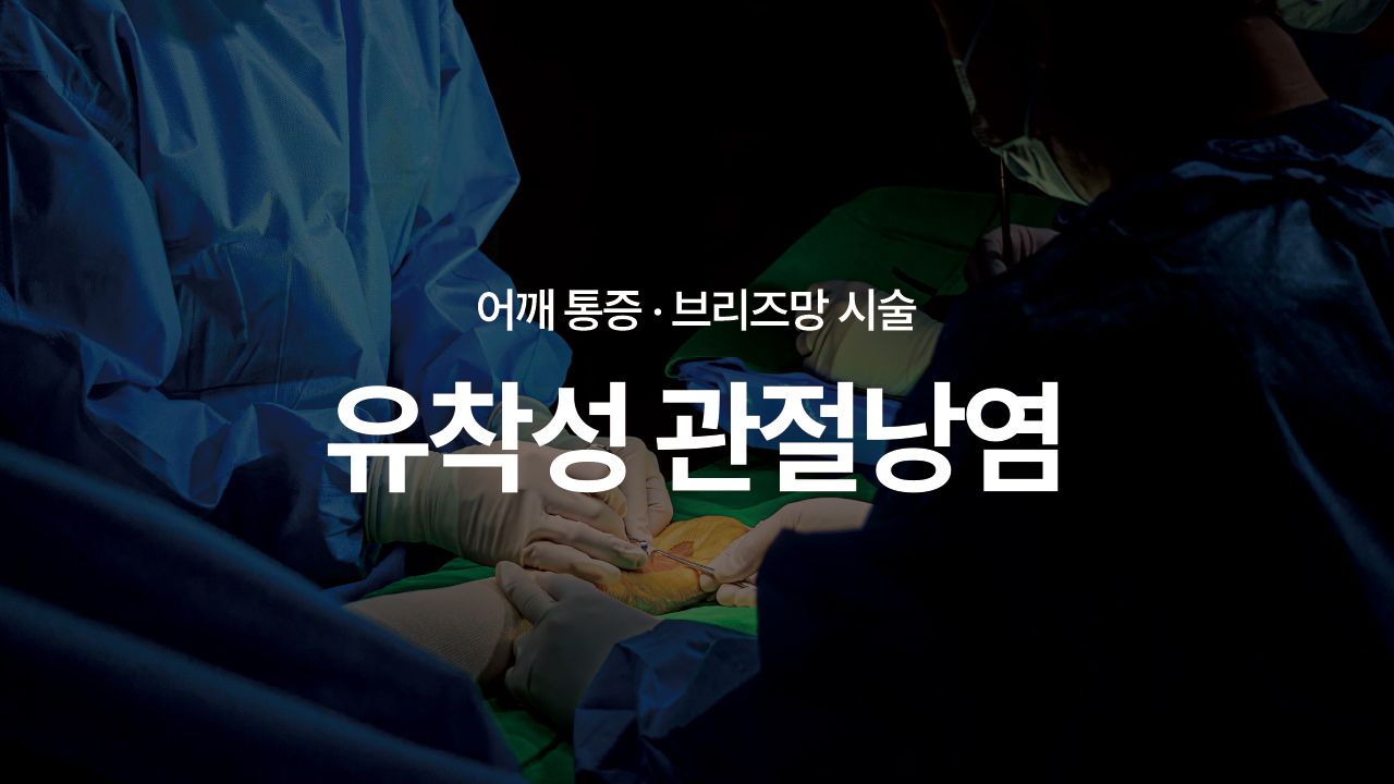 유착성 관절낭염
