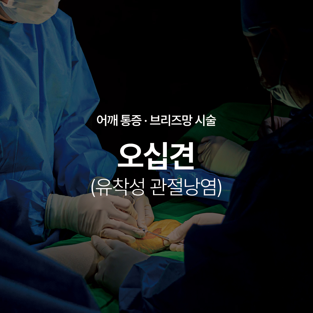 유착성 관절낭염