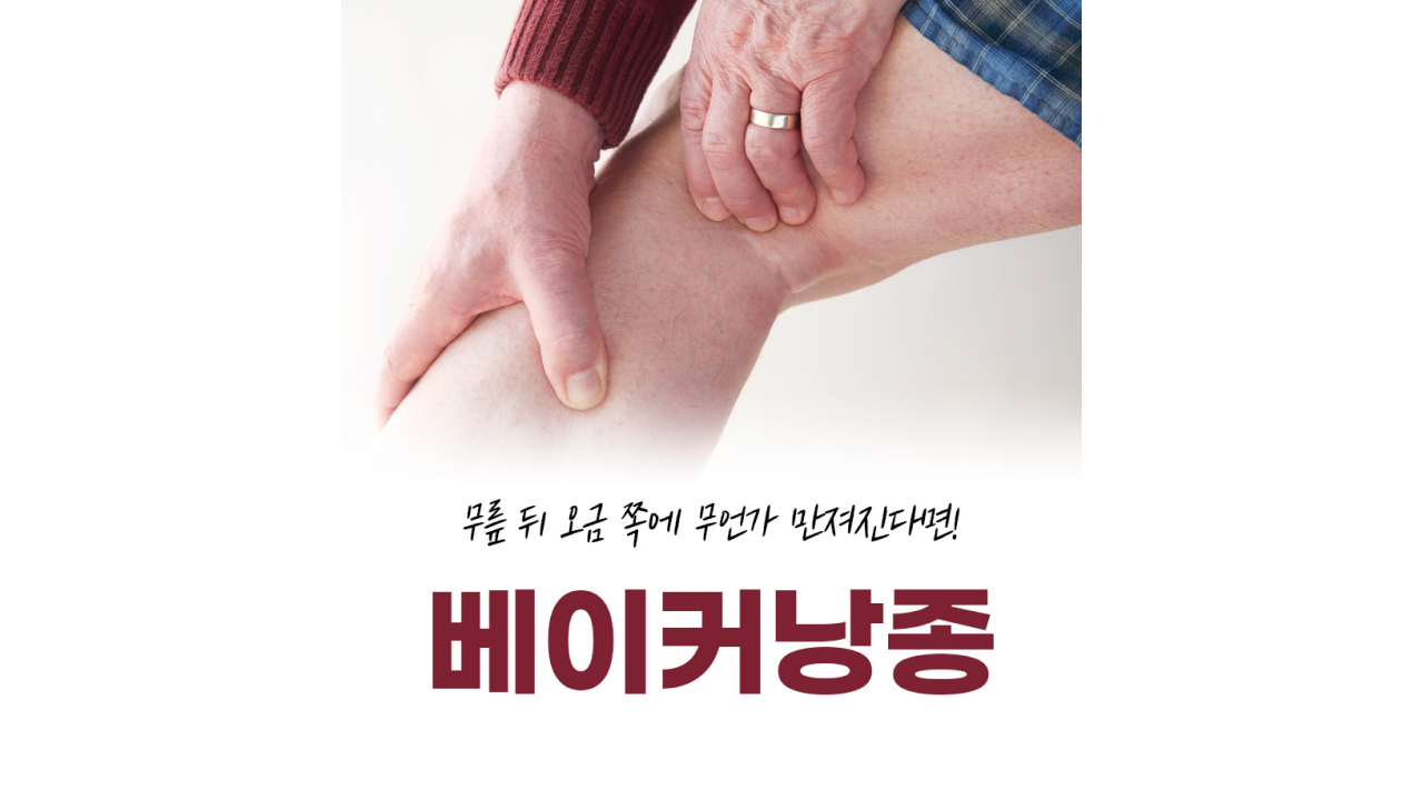 무릎 뒤 불편한 물혹이 있다면?